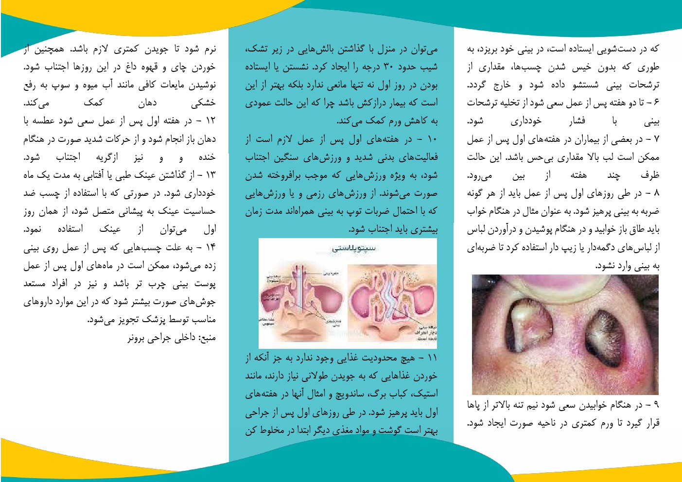 سيتوپلاستي2